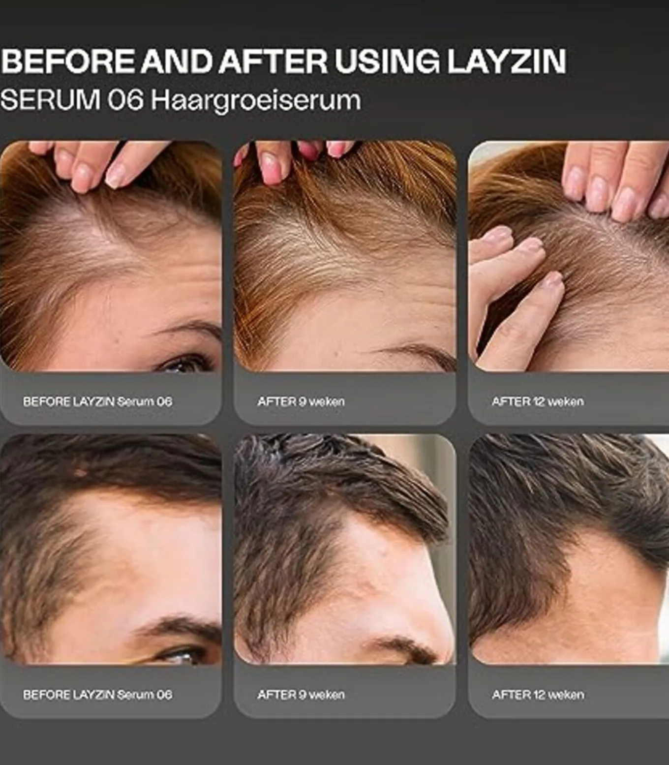 Haargroei Set minder haaruitval en meer haargroei