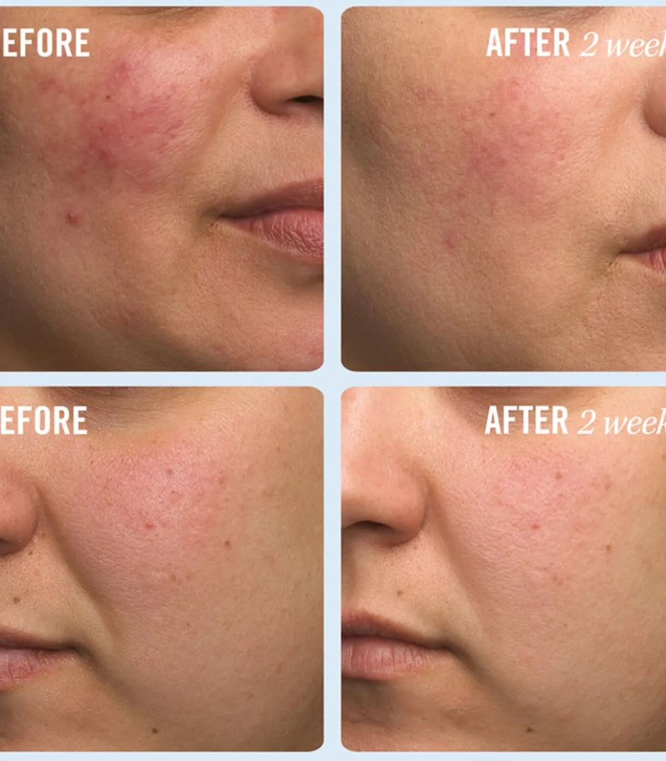 Ultra Repair Cream Intense Repair - 170 ml